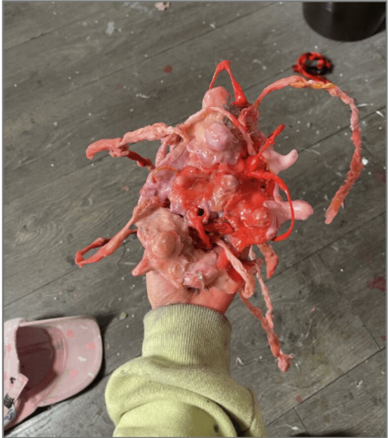 Pimple cultivation — 2023, melted plastic, 20×25 cm